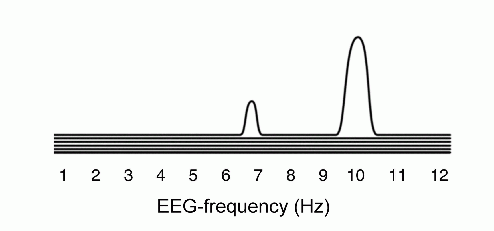 Schematic illustration of EEG coherence graph